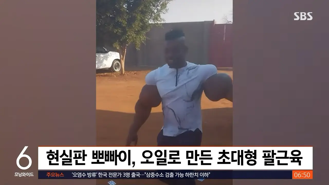 현실판 뽀빠이 '팔근육'…영상에 '경고' 표시 붙은 까닭  _ SBS _ 생생지구촌 0-28 screenshot.png